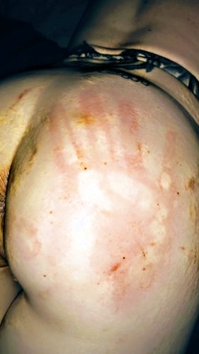 Severe ass whipping to orgasm